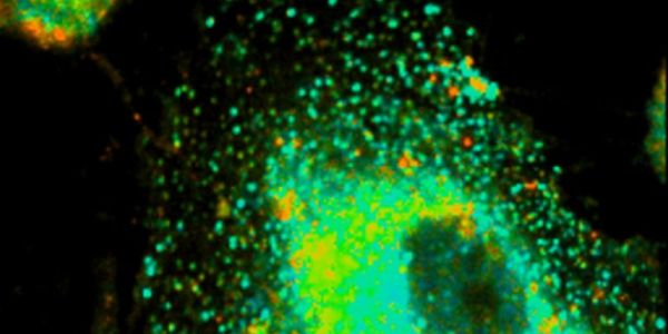 Green fluorescence of sample